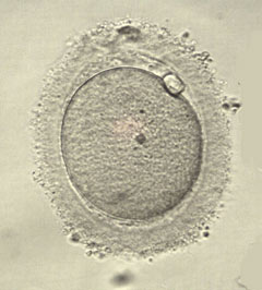 Mature oocyte with 1st polar body and the stage of metaphase II.